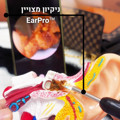 EarPro™ - מכשיר לניקוי אוזניים